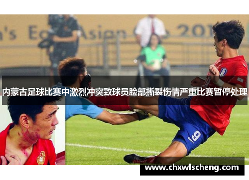 内蒙古足球比赛中激烈冲突致球员脸部撕裂伤情严重比赛暂停处理